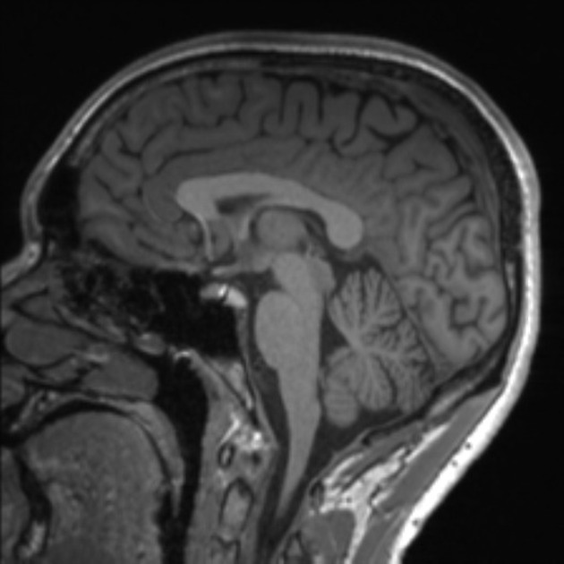 female_head.jpeg female_head.jpeg