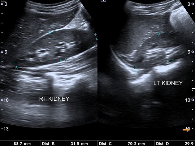 female_kidney.jpeg female_kidney.jpeg