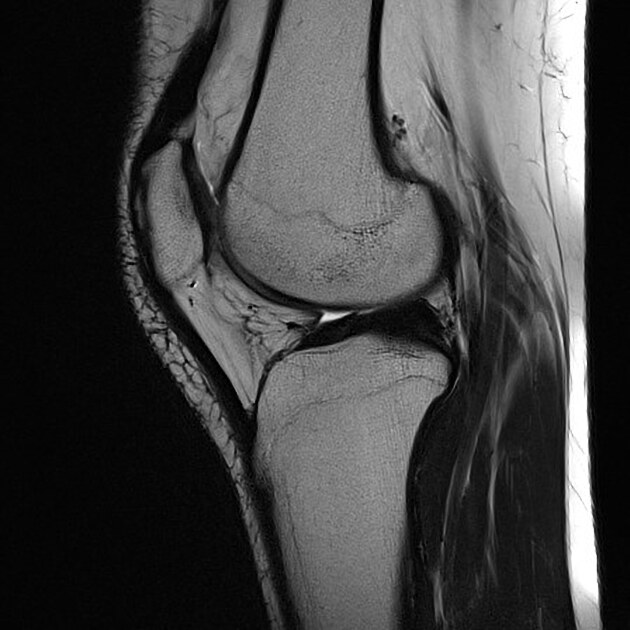 female_knee-(1).jpeg