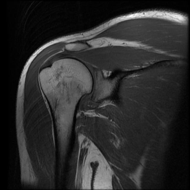 female_shoulder.jpg female_shoulder.jpg