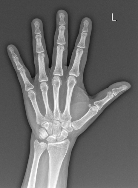 male_hand.jpeg male_hand.jpeg