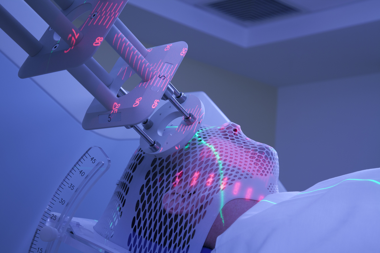 Intensive Radiotherapy What is image guided radiotherapy? | CoR