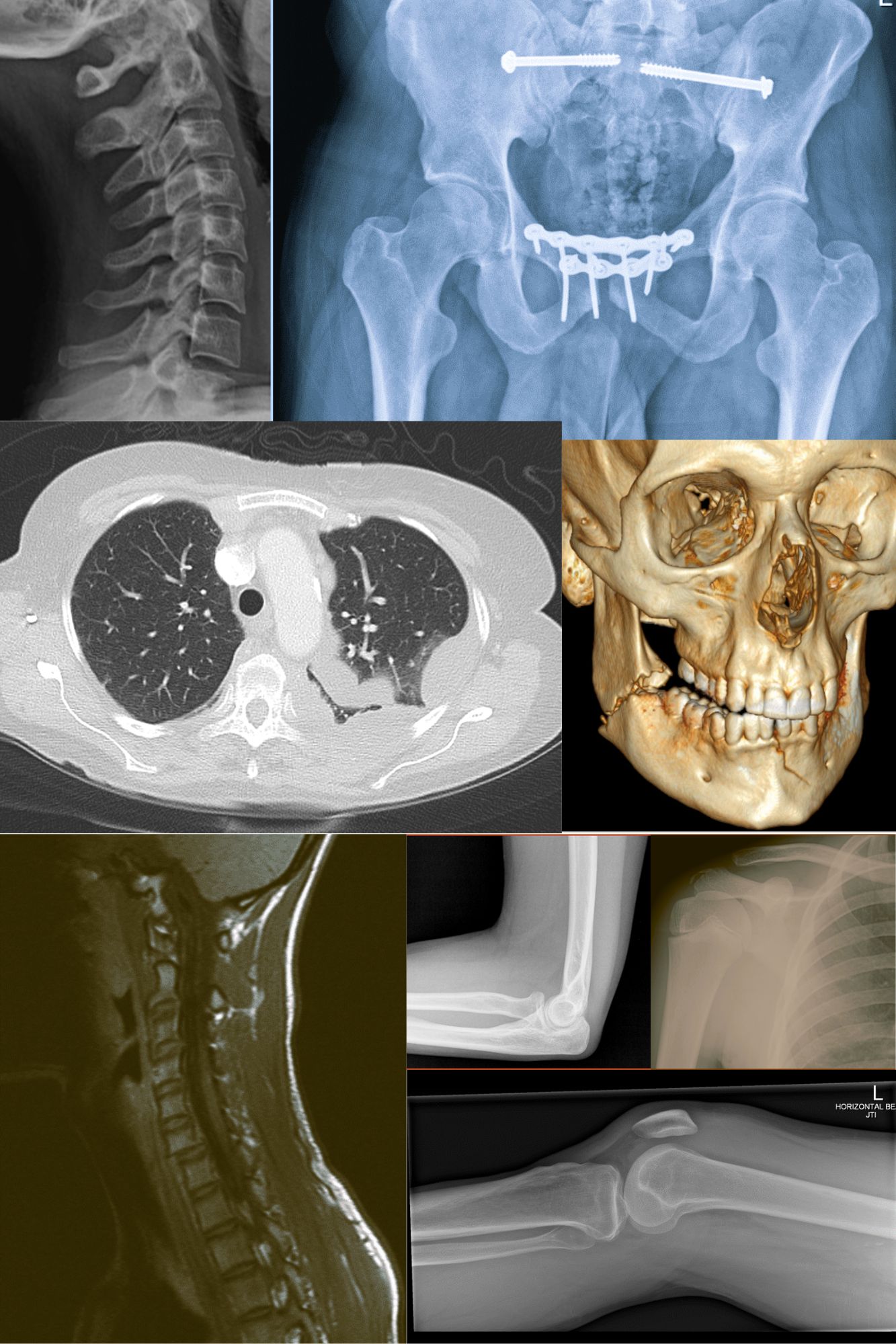 Reporting Radiographer SIG | SoR