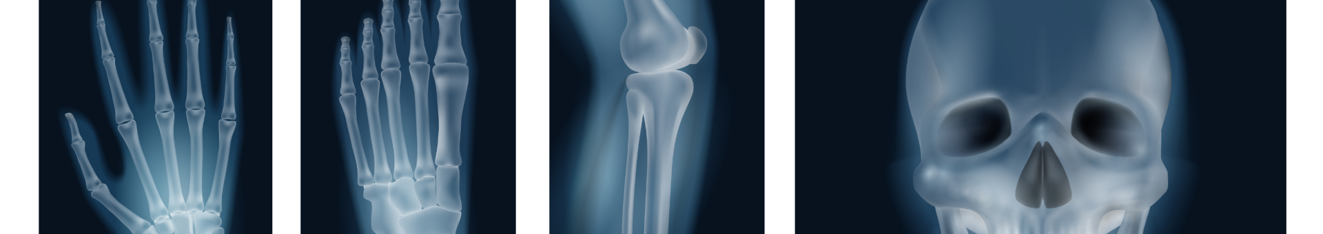 Projection radiography | SoR