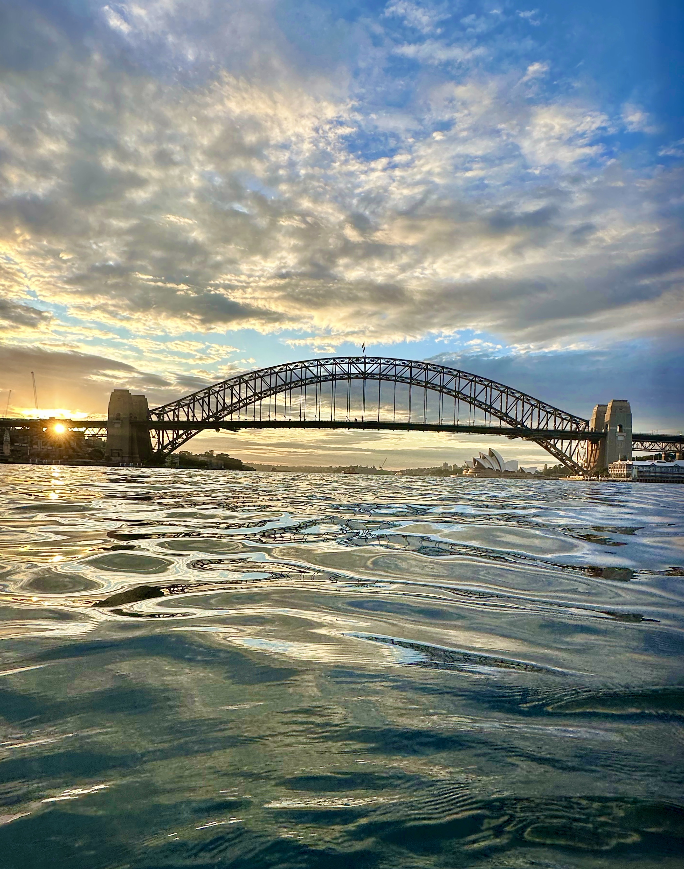 A radiographer’s experience in Australia | SoR