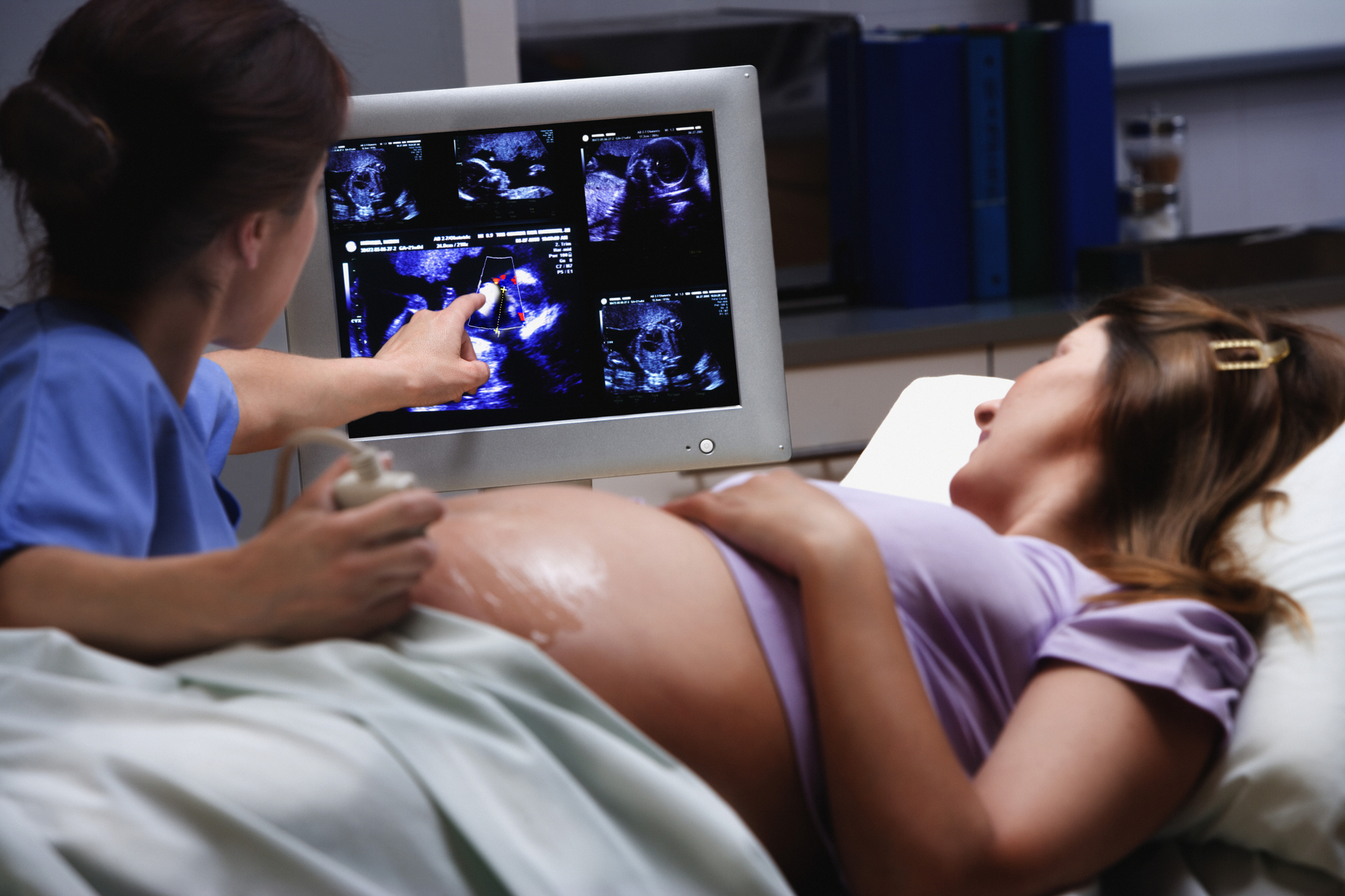 Pregnant women having ultrasound scan