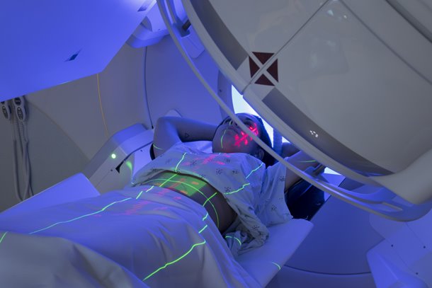 Radiotherapy Radiographic Workforce UK Census 2018