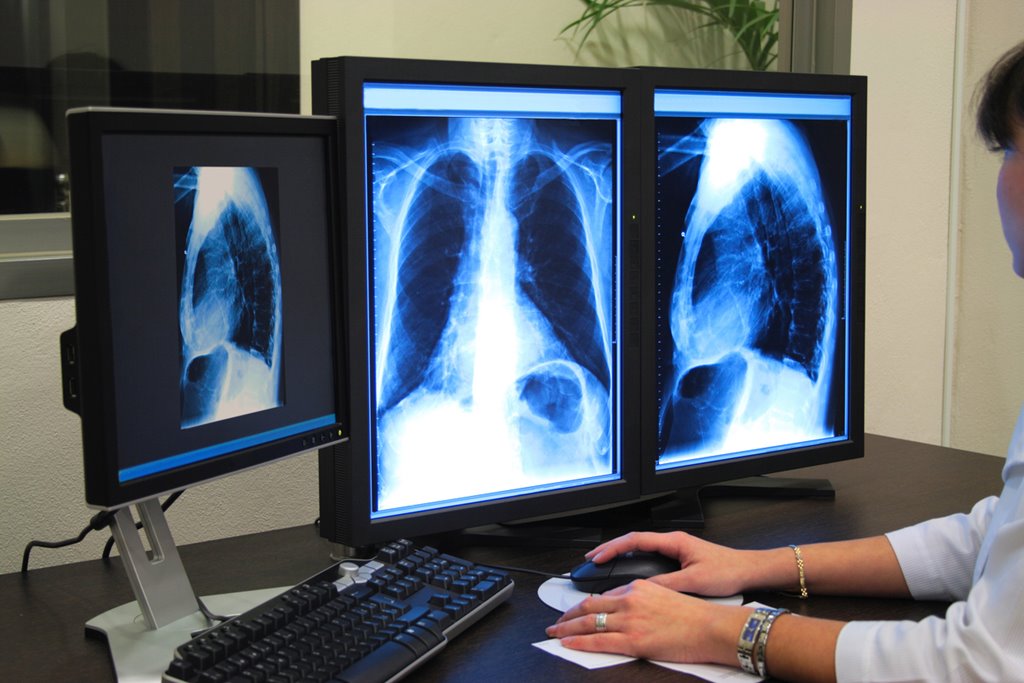 Recruitment of radiographers to increase and more reporting